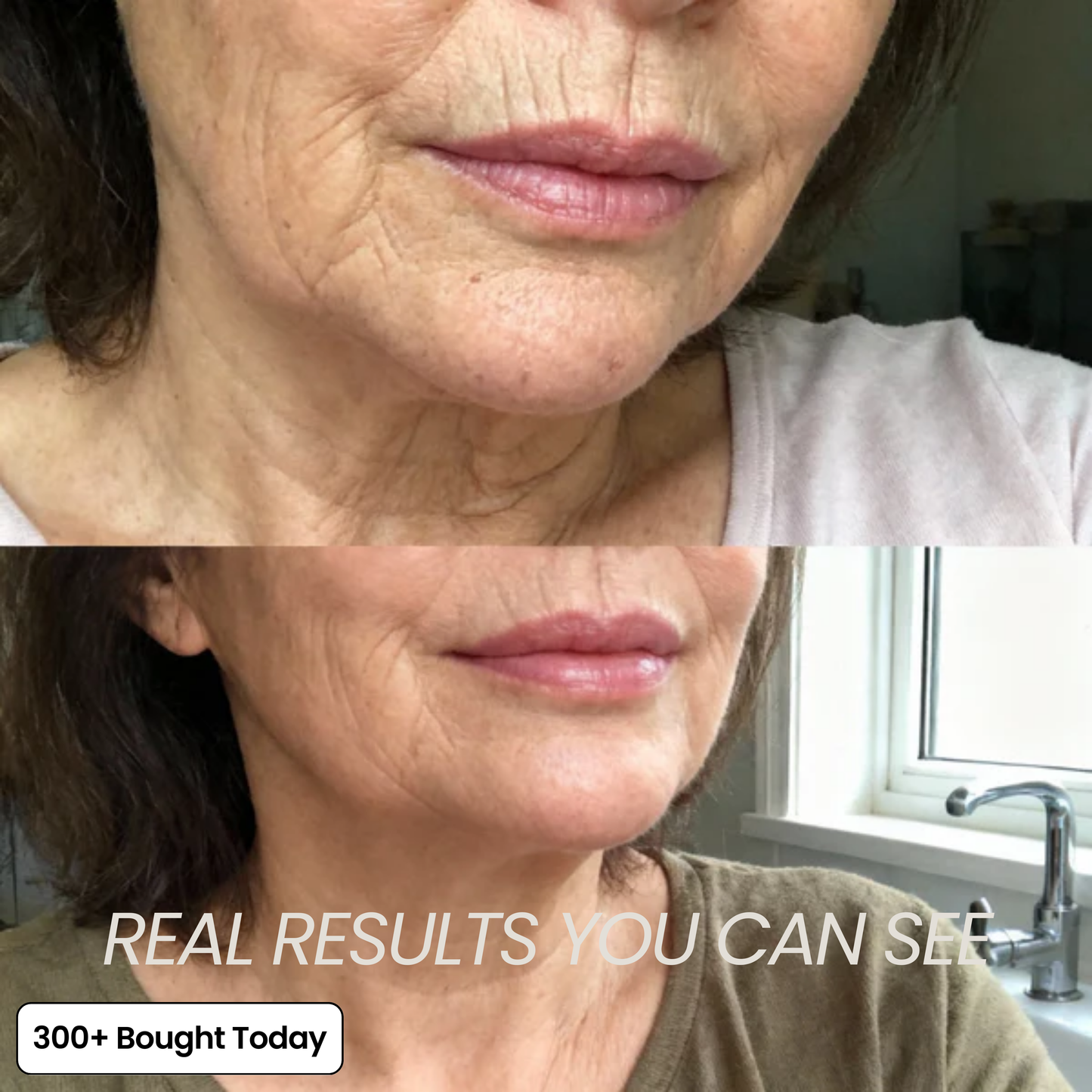 Serum Anti ride et cerne