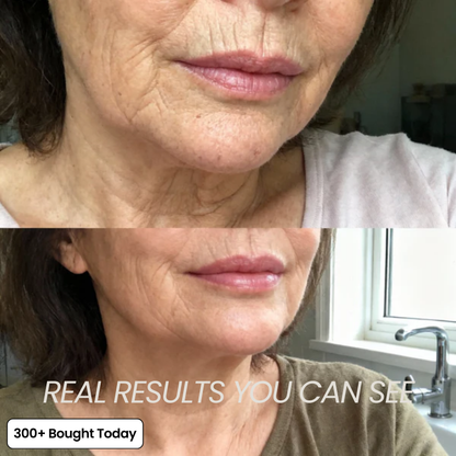 Serum Anti ride et cerne