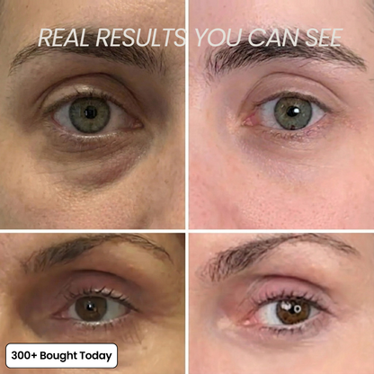 Serum Anti ride et cerne