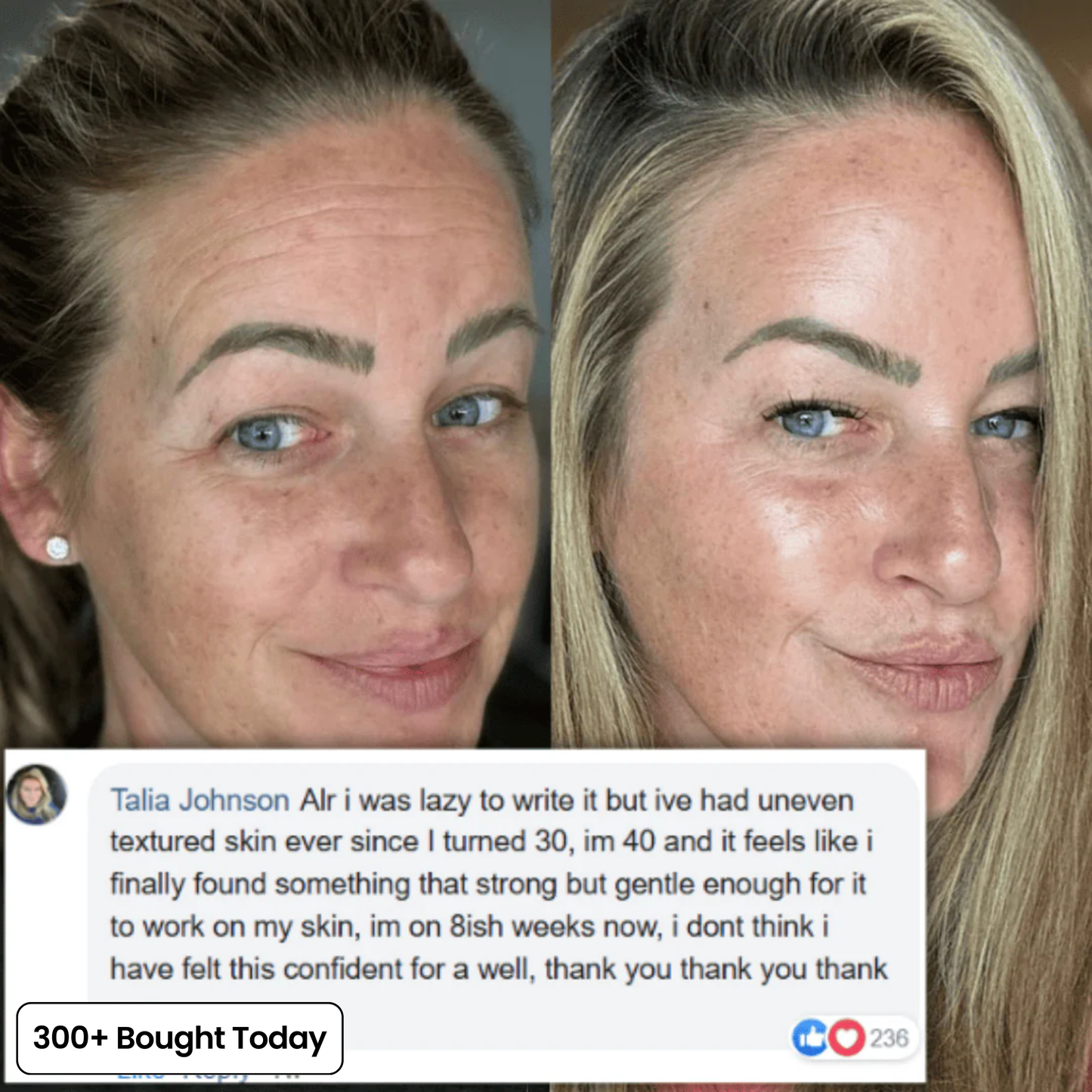 Serum Anti ride et cerne